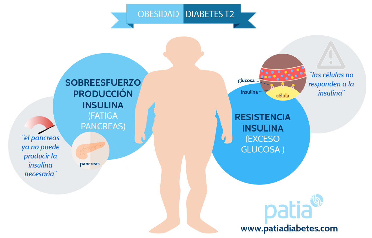 obesidad diabetes tipo 2 prevenir