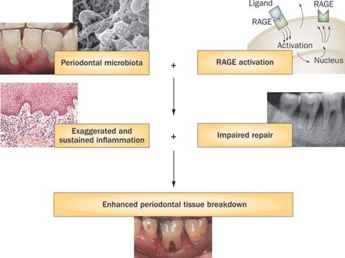 NATURE periodontitis & type 2 diabetes 